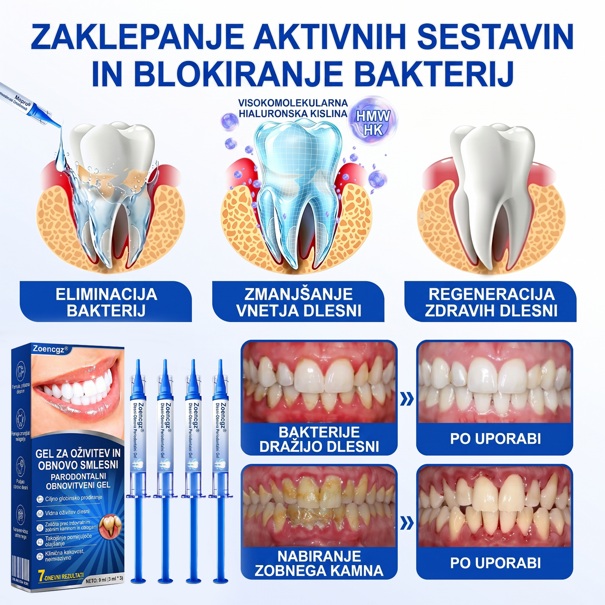 Zoencgz® 🦷🍫Antibakterijski gel za obnovo dlesni | Vidni učinki v 7 dneh