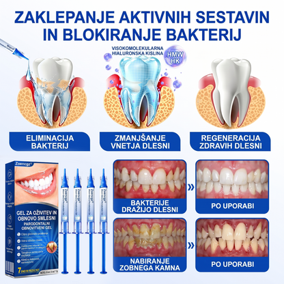 Zoencgz® 🦷🍫Antibakterijski gel za obnovo dlesni | Vidni učinki v 7 dneh