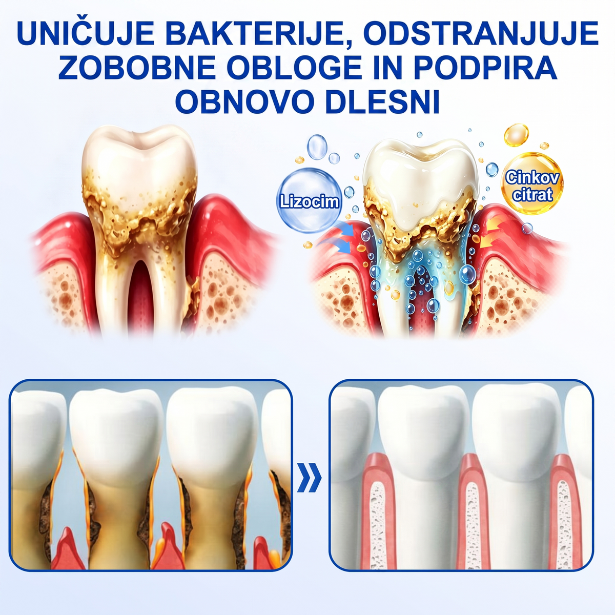 Zoencgz® 🦷🍫Antibakterijski gel za obnovo dlesni | Vidni učinki v 7 dneh