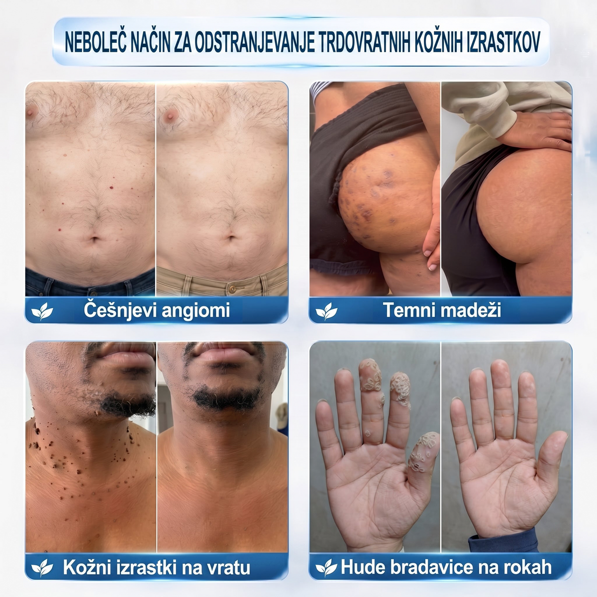 🌞🕶️𝐇𝐞𝐚𝐥𝐫𝐢𝐳𝐞® 7-𝑫𝒏𝒆𝒗𝒏𝒊 𝑶𝒅𝒔𝒕𝒓𝒂𝒏𝒋𝒆𝒗𝒂𝒏𝒋𝒆 𝑷𝒊𝒈𝒎𝒆𝒏𝒕𝒏𝒊𝒉 𝑴𝒂𝒅𝒆ž𝒆𝒗 𝑰𝒏 𝑩𝒓𝒂𝒛𝒈𝒐𝒕𝒊𝒏 𝑷𝒊𝒔𝒂𝒍𝒐(𝐵𝑟𝑒𝑧 𝑏𝑜𝑙𝑒č𝑖𝑛𝑒, 𝑏𝑟𝑒𝑧 𝑏𝑟𝑎𝑧𝑔𝑜𝑡𝑖𝑛 – 𝑟𝑜𝑙𝑙𝑒𝑟𝑏𝑎𝑙𝑙)💪