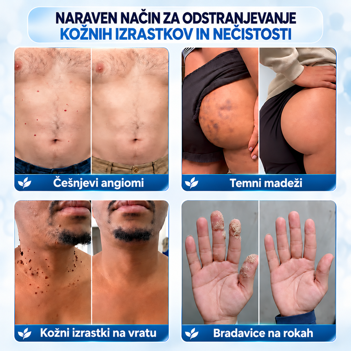 𝐇𝐞𝐚𝐥𝐫𝐢𝐳𝐞® ⭕7-dnevna nega za kožne izrastke in pigmentne madeže (nežna formula brez bolečin – brez brazgotin) 🌿2️⃣