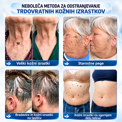 𝐇𝐞𝐚𝐥𝐫𝐢𝐳𝐞® ⭕7-dnevna nega za kožne izrastke in pigmentne madeže (nežna formula brez bolečin – brez brazgotin) 🌿2️⃣