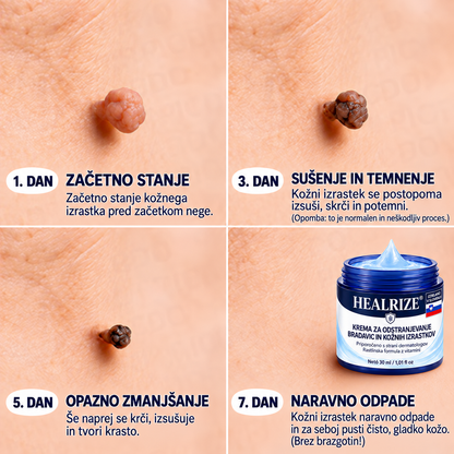 𝐇𝐞𝐚𝐥𝐫𝐢𝐳𝐞® ⭕7-dnevna nega za kožne izrastke in pigmentne madeže (nežna formula brez bolečin – brez brazgotin) 🌿2️⃣