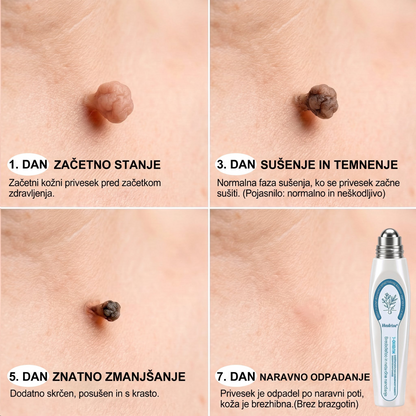🌞🕶️𝐇𝐞𝐚𝐥𝐫𝐢𝐳𝐞® 7-𝑫𝒏𝒆𝒗𝒏𝒊 𝑶𝒅𝒔𝒕𝒓𝒂𝒏𝒋𝒆𝒗𝒂𝒏𝒋𝒆 𝑷𝒊𝒈𝒎𝒆𝒏𝒕𝒏𝒊𝒉 𝑴𝒂𝒅𝒆ž𝒆𝒗 𝑰𝒏 𝑩𝒓𝒂𝒛𝒈𝒐𝒕𝒊𝒏 𝑷𝒊𝒔𝒂𝒍𝒐(𝐵𝑟𝑒𝑧 𝑏𝑜𝑙𝑒č𝑖𝑛𝑒, 𝑏𝑟𝑒𝑧 𝑏𝑟𝑎𝑧𝑔𝑜𝑡𝑖𝑛 – 𝑟𝑜𝑙𝑙𝑒𝑟𝑏𝑎𝑙𝑙)💪