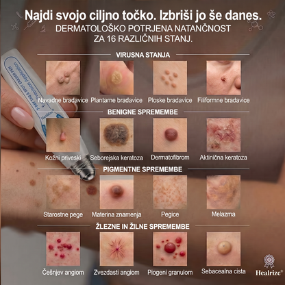 🌞🕶️𝐇𝐞𝐚𝐥𝐫𝐢𝐳𝐞® 7-𝑫𝒏𝒆𝒗𝒏𝒊 𝑶𝒅𝒔𝒕𝒓𝒂𝒏𝒋𝒆𝒗𝒂𝒏𝒋𝒆 𝑷𝒊𝒈𝒎𝒆𝒏𝒕𝒏𝒊𝒉 𝑴𝒂𝒅𝒆ž𝒆𝒗 𝑰𝒏 𝑩𝒓𝒂𝒛𝒈𝒐𝒕𝒊𝒏 𝑷𝒊𝒔𝒂𝒍𝒐(𝐵𝑟𝑒𝑧 𝑏𝑜𝑙𝑒č𝑖𝑛𝑒, 𝑏𝑟𝑒𝑧 𝑏𝑟𝑎𝑧𝑔𝑜𝑡𝑖𝑛 – 𝑟𝑜𝑙𝑙𝑒𝑟𝑏𝑎𝑙𝑙)💪