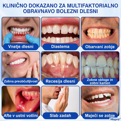 Zoencgz® 🦷🍫Antibakterijski gel za obnovo dlesni | Vidni učinki v 7 dneh